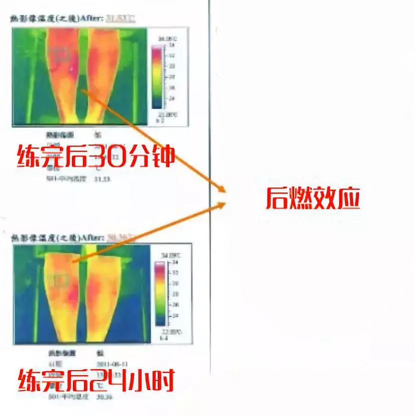 “小腿粗”毁了多少女生?每天15分钟,我的小粗腿消失了......