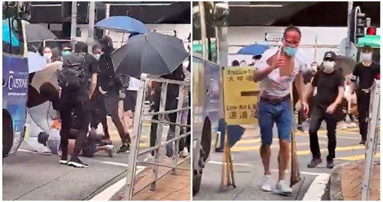 ▲陈子迁24日被黑衣人围殴,满身多处受伤 (图片泉源:香港《巴士的报》)