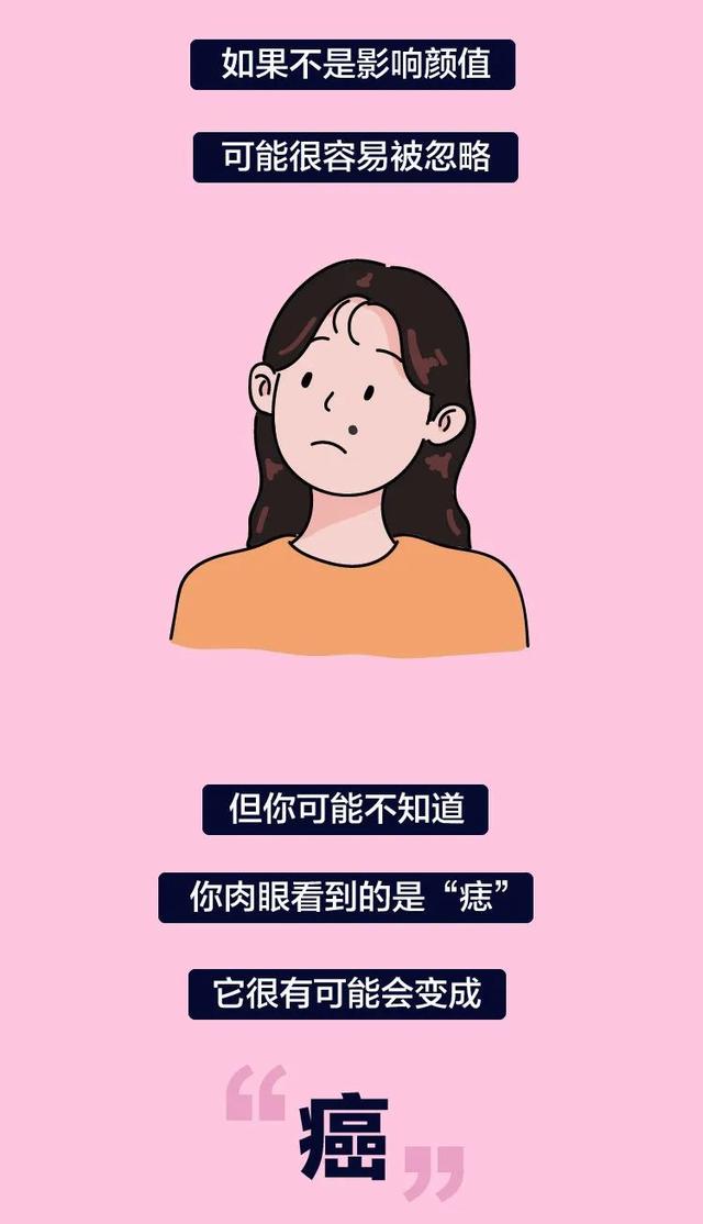 长这种痣可能会癌变,这5种痣不容忽视