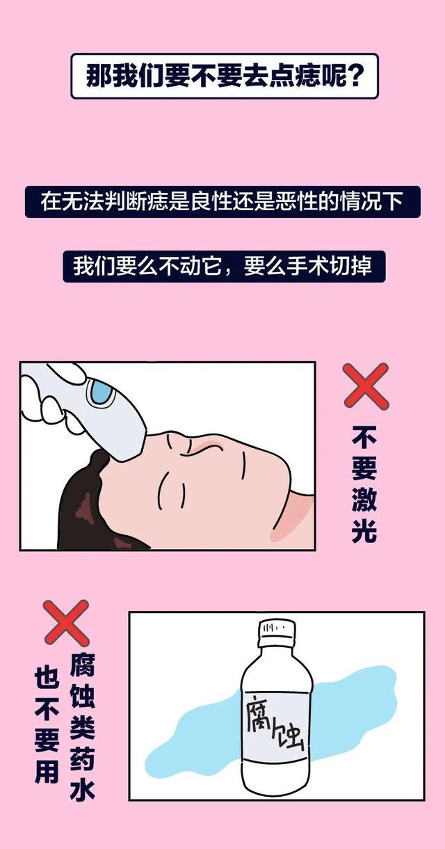 长这种痣可能会癌变,这5种痣不容忽视