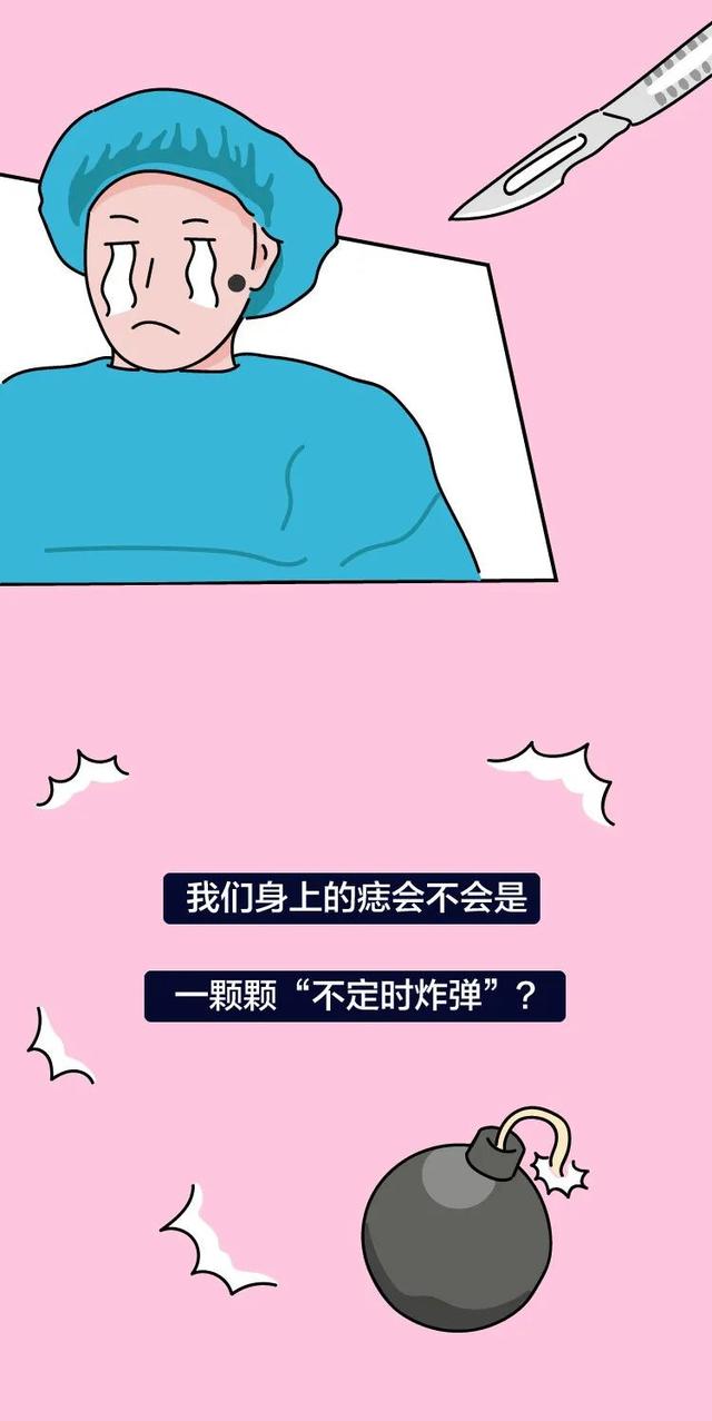 长这种痣可能会癌变,这5种痣不容忽视