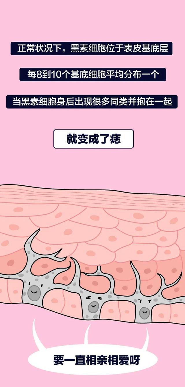 长这种痣可能会癌变,这5种痣不容忽视