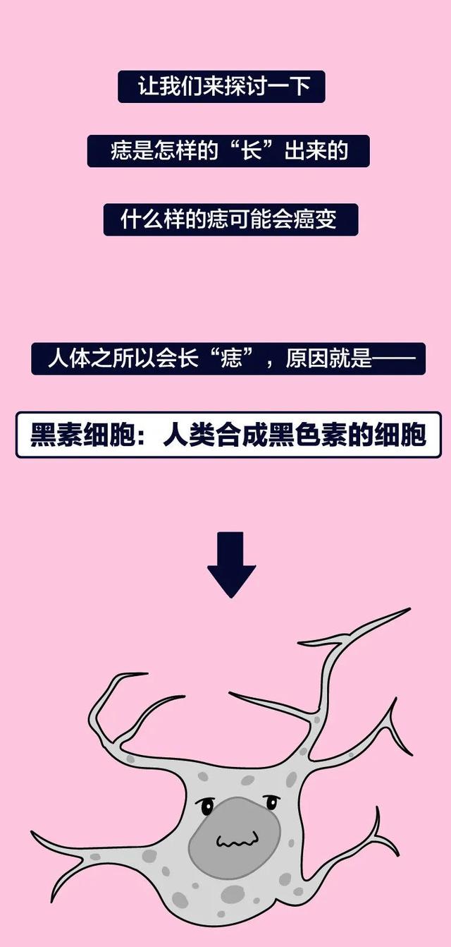 长这种痣可能会癌变,这5种痣不容忽视