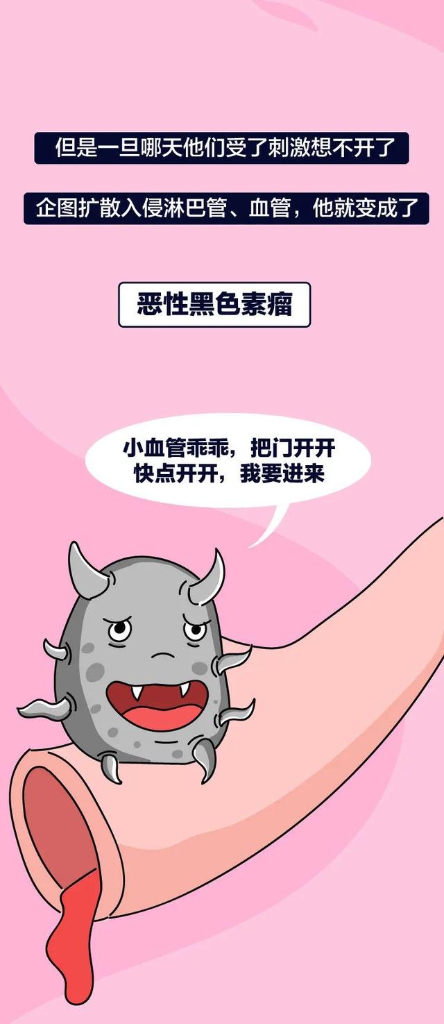 长这种痣可能会癌变,这5种痣不容忽视