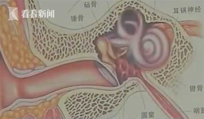 失聪人口_失聪病例单图片(3)