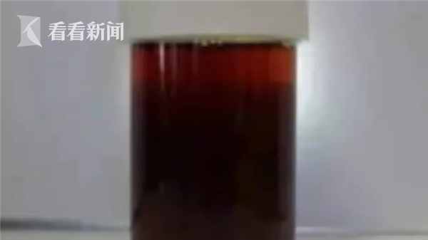 小伙健身三天尿液变成酱油色！医生和他都傻眼