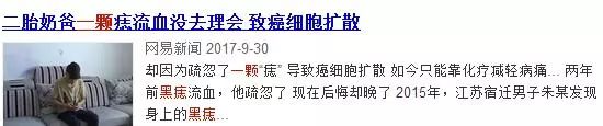 痣也可能癌变?赶紧看看,身上有这些痣要小心了!
