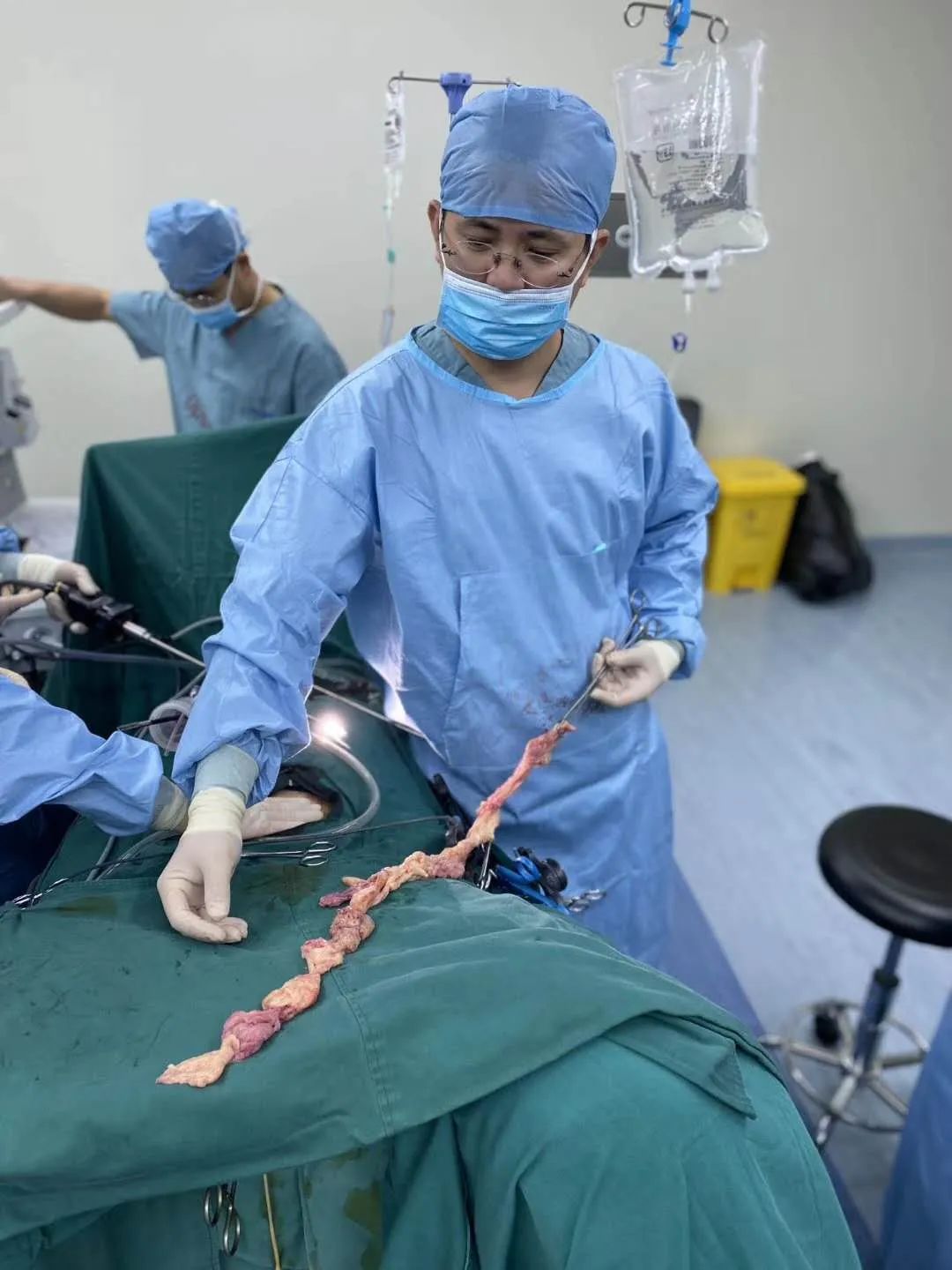 图4.单孔腹腔镜切除出来的12cm的子宫肌瘤