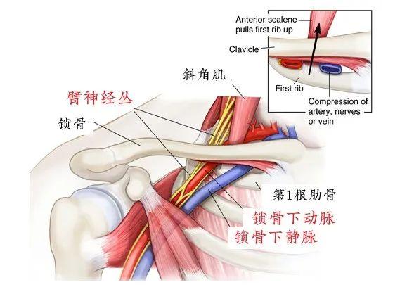 锁骨太过饱满,摸起来还很硬?很可能是你这长了肿瘤