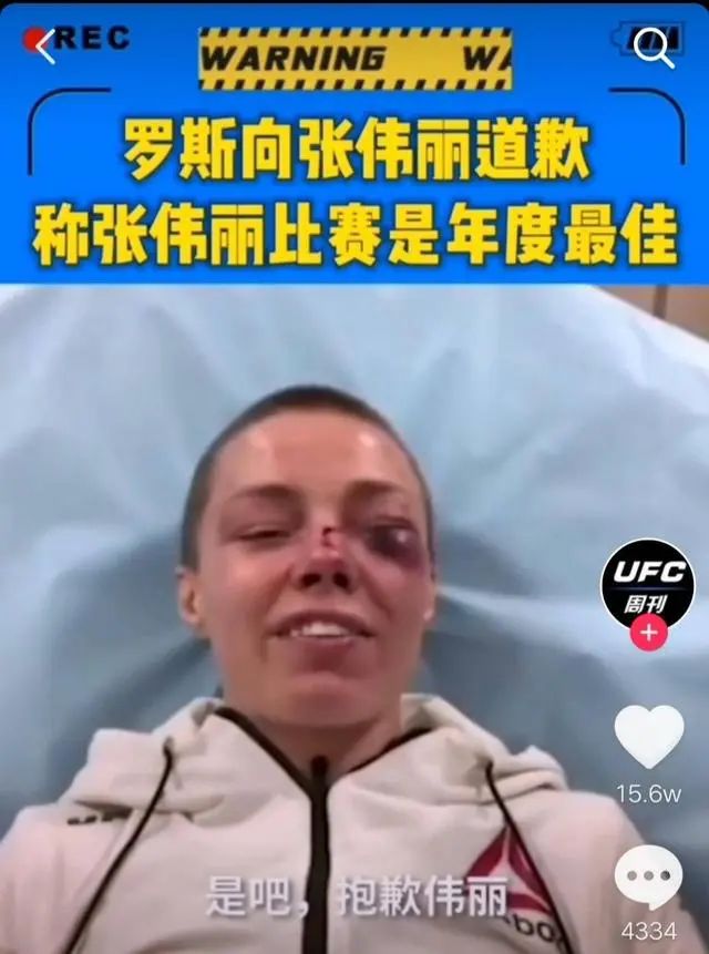 张伟丽场外征服对手?下一个卫冕对手出炉,鼻青脸肿向张伟丽道歉