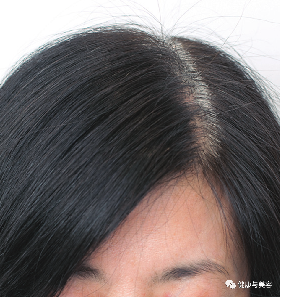 陈若仪的懒人染发方法火了,掩藏白发还需要这两种发型