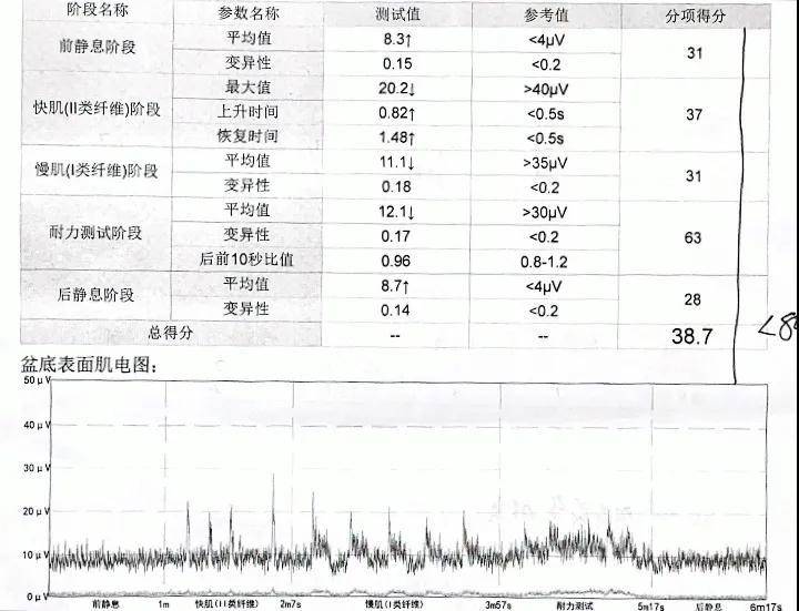 咳嗽就漏尿,宝妈产后几年了,做盆底康复还有用吗?
