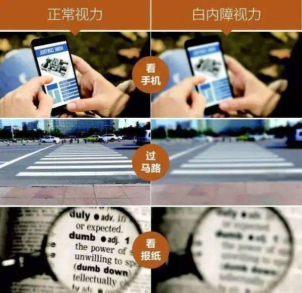 山东省知名眼科专家马先祯:白内障手术早已不是单纯的复明手术