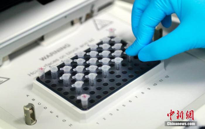 资料图:科研人员在演示新型冠状病毒mRNA疫苗研发实验过程。 汤彦俊 摄