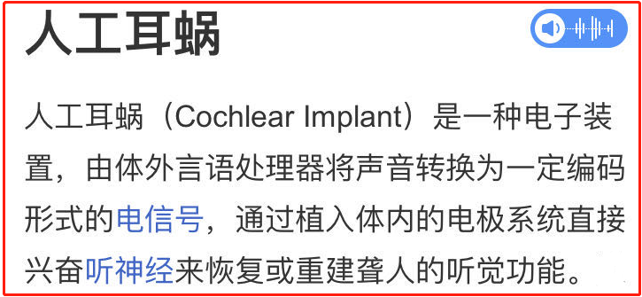 人工耳蜗,没用?