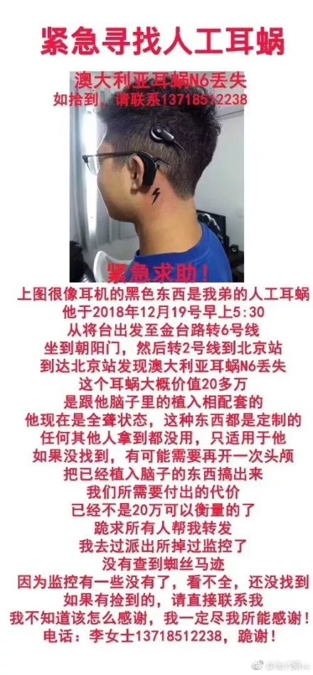 人工耳蜗,没用?