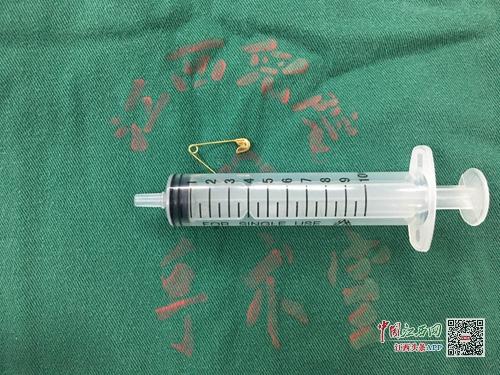 危险!江西一婴儿误吞分叉别针 卡在食道12个小时