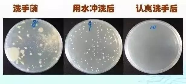 老生常谈的“勤洗手”,你真的做到了吗?