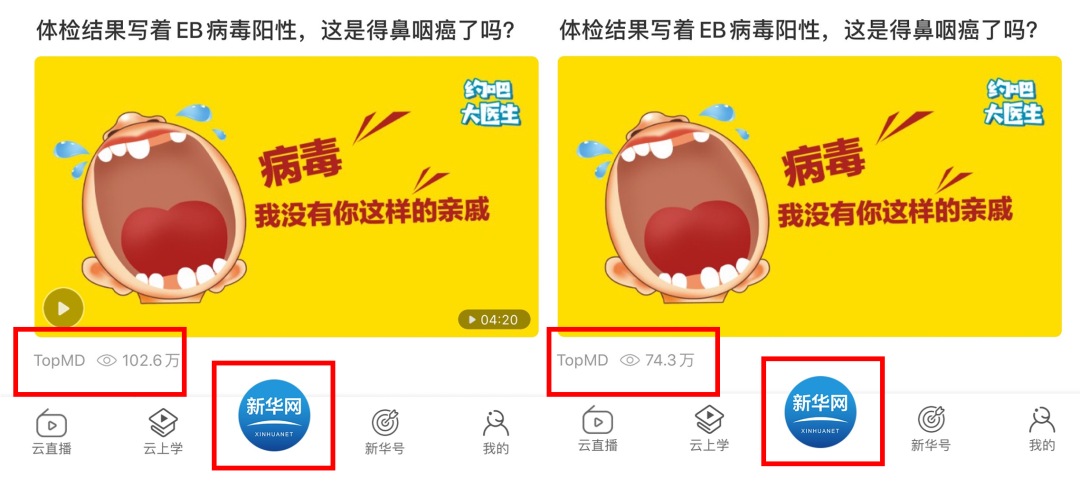 250w+观看!体检结果写着EB病毒阳性,这是得鼻咽癌了吗?