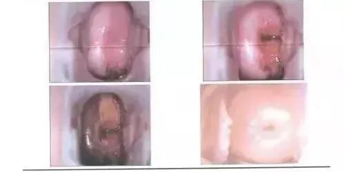 这种专坑女性的「妇科病」,其实根本不用治!︱健康日历