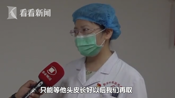 割头皮救烧伤母亲 儿子:身上的皮随时给我娘