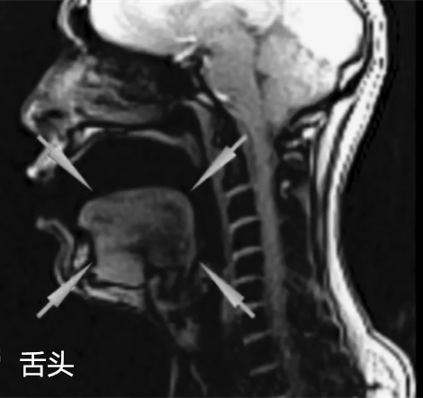 科学有意思 声音是如何从喉咙发出的?在核磁共振下唱歌试试