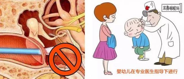 「儿童科普」 这病有点像感冒,其实却是中耳炎
