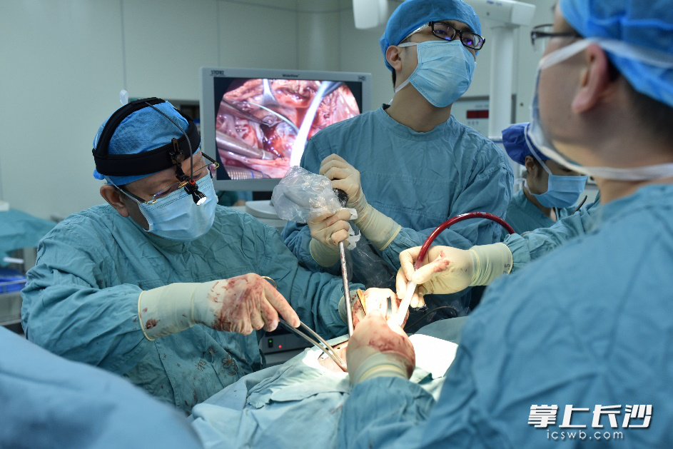 全球首例!39岁男子心脏长在右边,湘雅二医院为镜面人进行“迷宫手术”