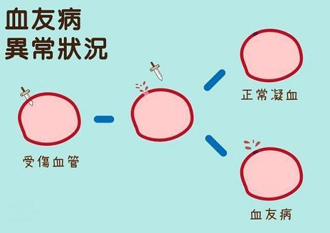 你知道为什么血友病患者大多数是男性吗？答案相信你也猜到了