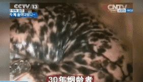 内窥镜下的"烟肺",你见过吗?戒烟后,患肺癌的概率还有