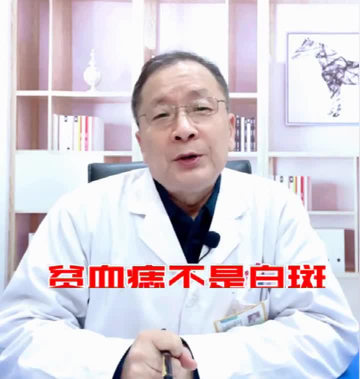济南中医白癜风医院:贫血痣不是白斑,是皮肤疾病