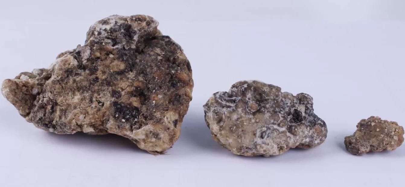 价值150万美元：也门渔民鲸尸内发现龙涎香，为何价...