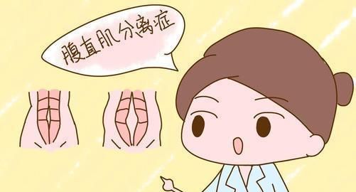 产后腹直肌分离是可以自己恢复的,但是如果腹直肌分离超过了三指,则不