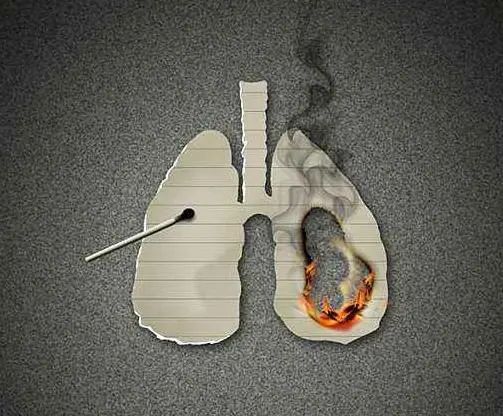 肺病多是吸烟惹得祸!身体出现2黑3痛,最好查下肺ct