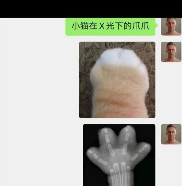 08 小猫咪在x光下的爪爪,有一说一,太可爱了吧.