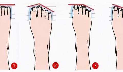 脚的胖瘦怎么分类