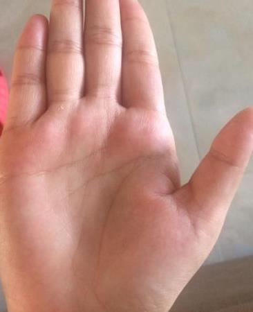 手上一旦出现二婚线这样的女人必定婚姻不幸二婚才幸福