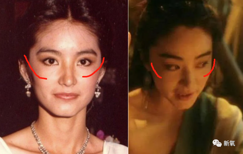 眼眶骨下凹,颧弓外扩,显得上面部脸又凹,骨骼感明显.