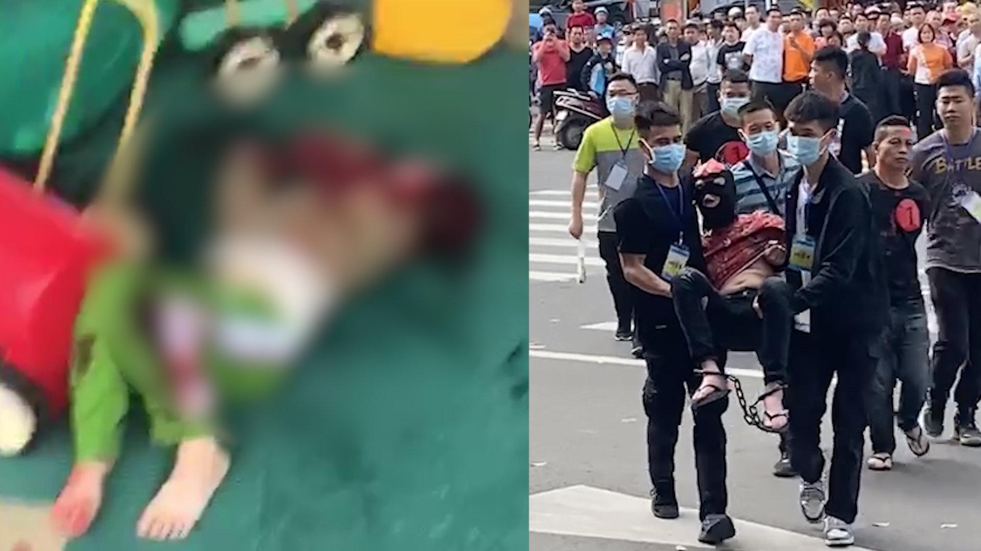 武汉黄陂：女童摔伤头部血流不止，辅警紧急护送就医