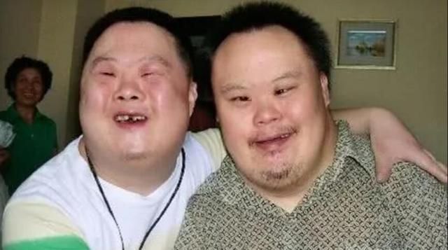 为什么唐氏综合征,几乎都长得一样?看完我懂了