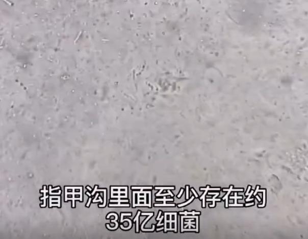 孩子喜欢啃指甲,妈妈别不当回事儿,细菌可多了! 孩子喜欢啃指甲,妈妈别不当回事儿,细菌可多了!