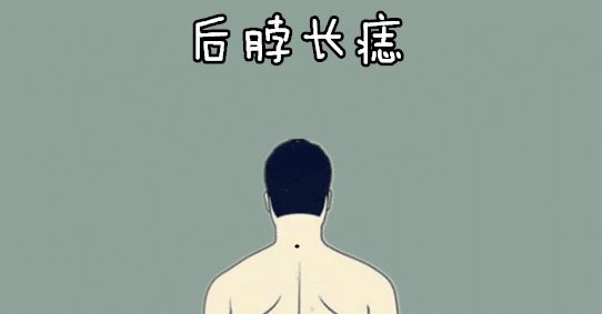 千金难买5颗痣男人升官女人升福值大钱福泽子子辈辈