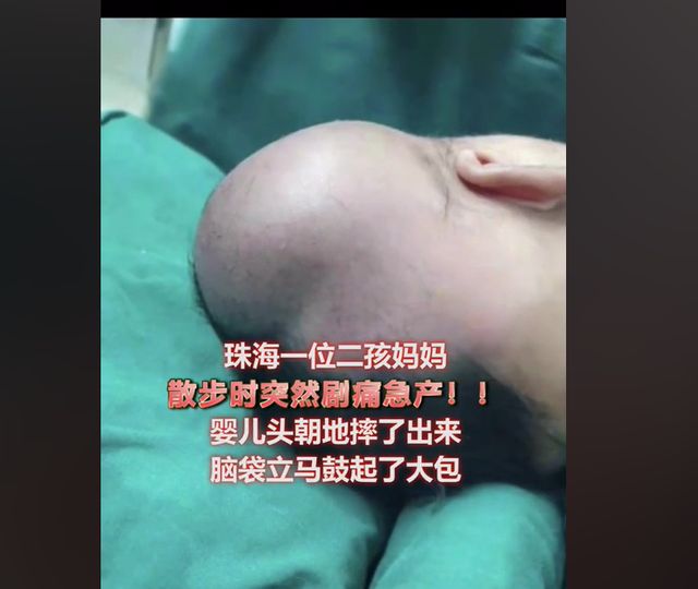 产妇在家如厕产女,邻居护士帮忙从马桶捞出孩子,发现没有呼吸休闲区蓝鸢梦想 - Www.slyday.coM 产妇在家如厕产女,邻居护士帮忙从马桶捞出孩子,发现没有呼吸休闲区蓝鸢梦想 - Www.slyday.coM