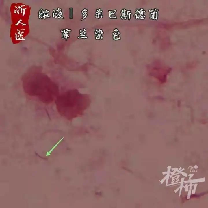 高温天“毛孩子”突然“翻脸”,有女子被自家宠物咬伤险截肢休闲区蓝鸢梦想 - Www.slyday.coM 高温天“毛孩子”突然“翻脸”,有女子被自家宠物咬伤险截肢休闲区蓝鸢梦想 - Www.slyday.coM