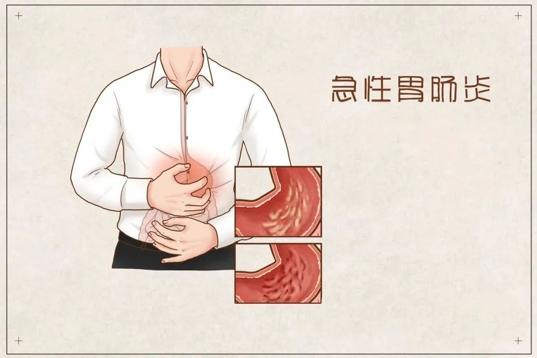 急性胃肠炎的病因有哪些?