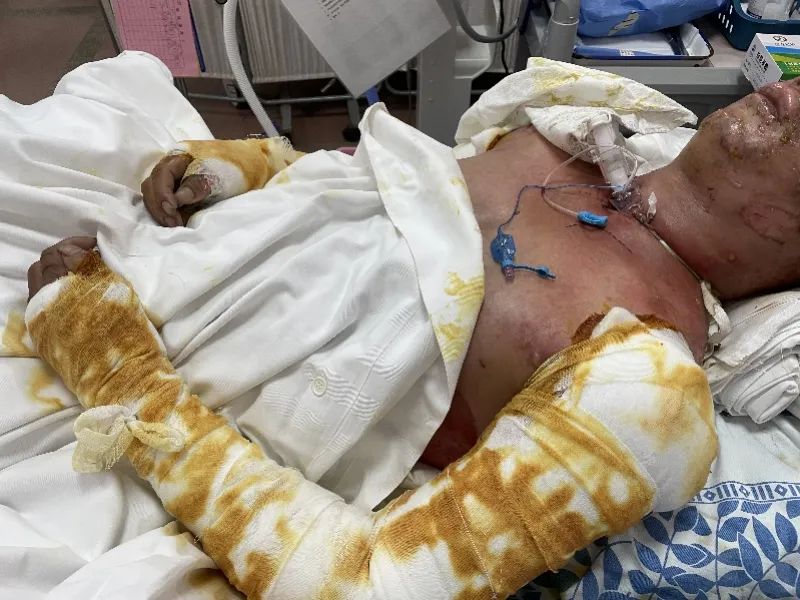 注意丨教训!室内的“它”突发爆燃!今天起,“它”不能进楼了!违规最高可罚1万元!休闲区蓝鸢梦想 - Www.slyday.coM 注意丨教训!室内的“它”突发爆燃!今天起,“它”不能进楼了!违规最高可罚1万元!休闲区蓝鸢梦想 - Www.slyday.coM