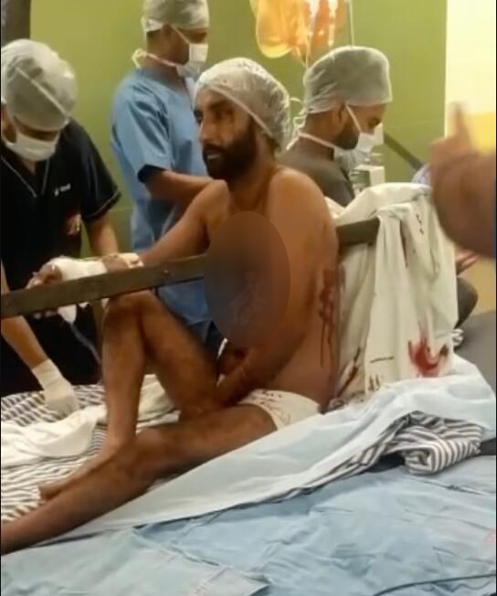 印度一名司机在车祸中被钢管刺穿胸部 奇迹般存活休闲区蓝鸢梦想 - Www.slyday.coM 印度一名司机在车祸中被钢管刺穿胸部 奇迹般存活休闲区蓝鸢梦想 - Www.slyday.coM