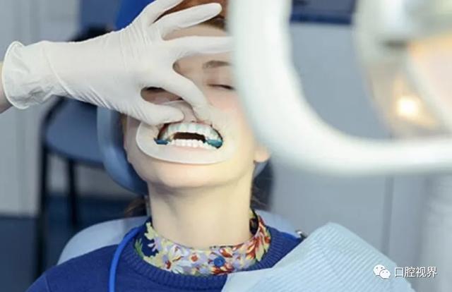 如何美白牙齿（如何美白牙齿最安全）