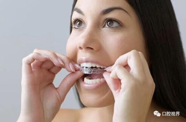 如何美白牙齿（如何美白牙齿最安全）