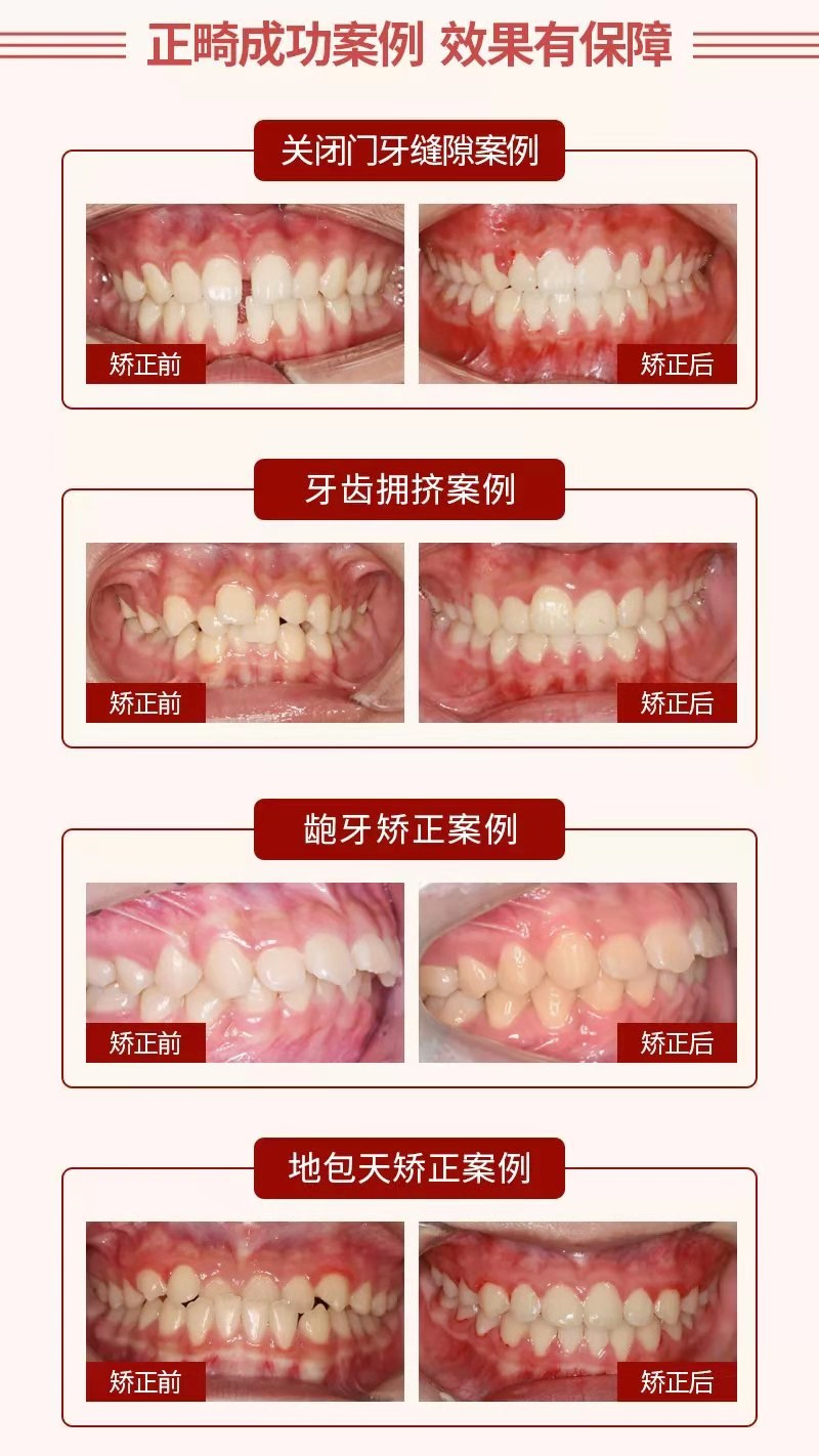 义乌|牙齿|口腔